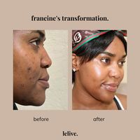 Lelive. Bestselling 3 Step Routine - Brighten, Clarify + Glow All Skin Types